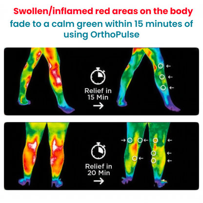 OrthoPulse™ - Intelligent Knee Massager